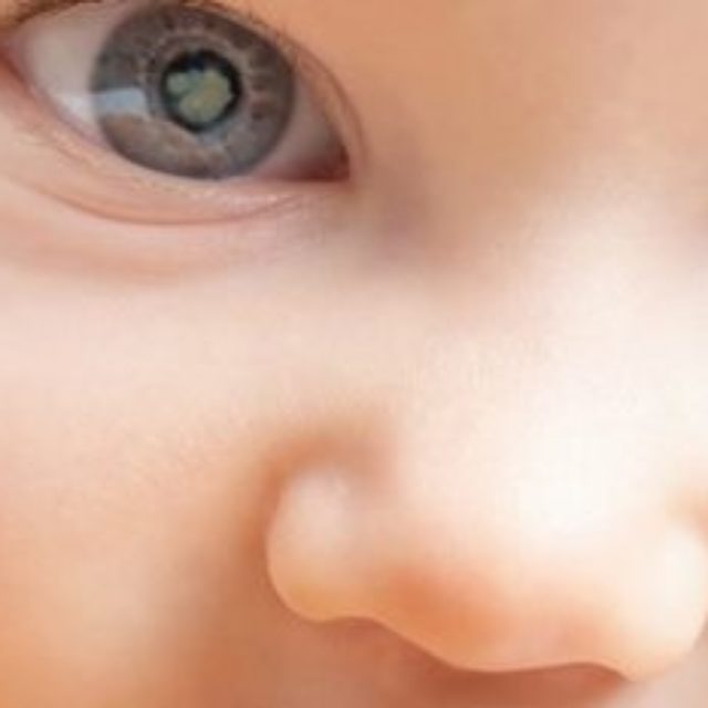 Вроджена катаракта