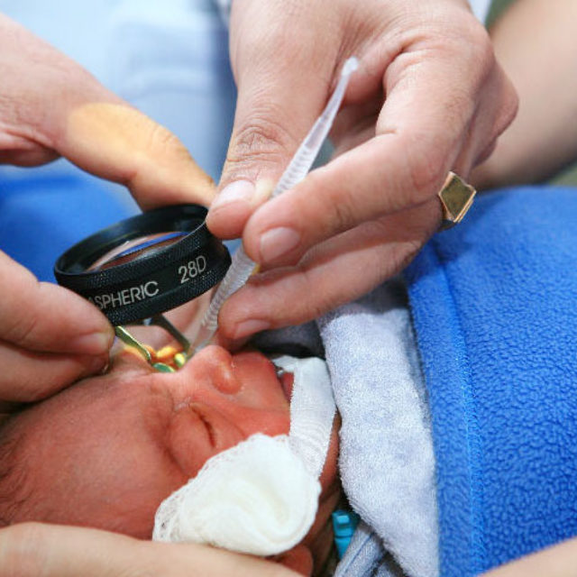 Включення в склоподібному тілі можуть відіграти важливу роль в скринінгу ретинопатії недоношених