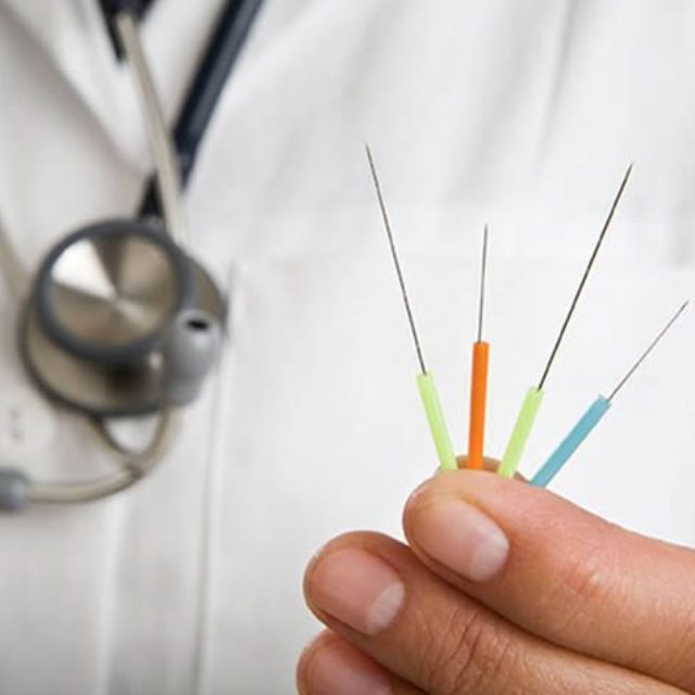 Позитивний короткочасний вплив акупунктури на параметри окулярного кровотоку у хворих з первинною відкритокутовою глаукомою