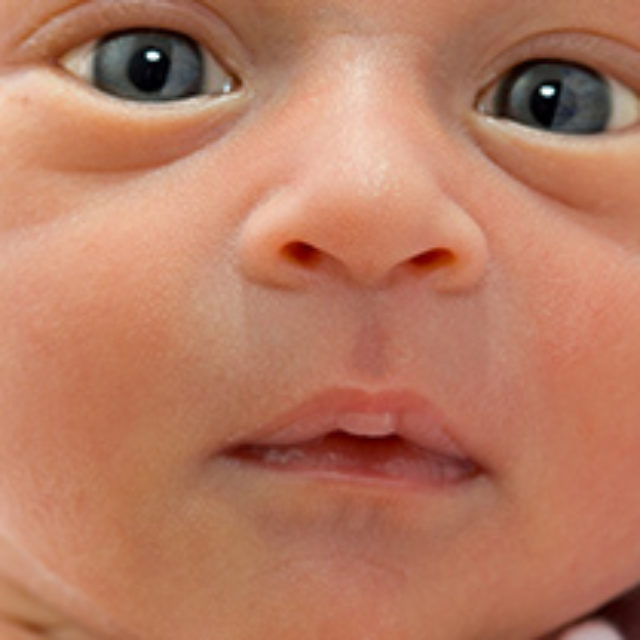 Порівняння ефективності лазерної фотокоагуляції та anti-VEGF препаратів для лікування ретинопатії недоношених