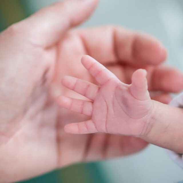 Лазерне лікування ретинопатії недоношених може призвести до пізніх аномалій розвитку ока