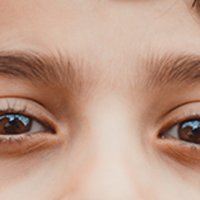 Субанестетичні дози кетаміну здатні допомогти у лікуванні амбліопії в дорослому віці