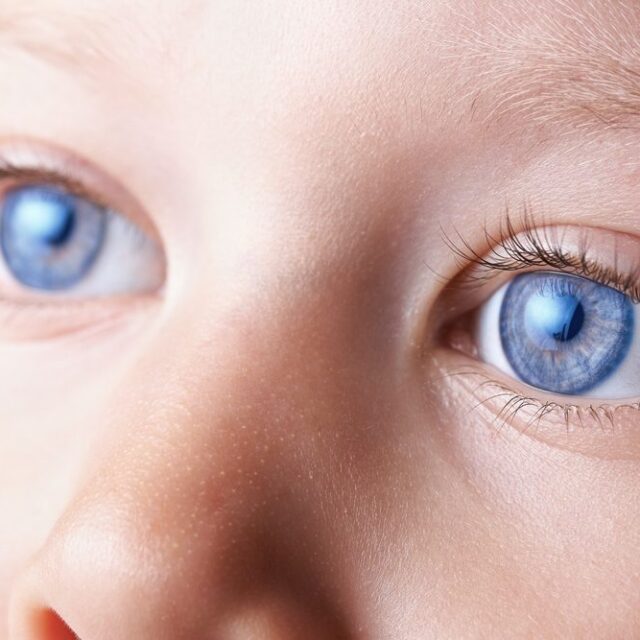 Особливості перебігу увеїту, пов’язаного із ювенільним ідіопатичним артритом у дітей