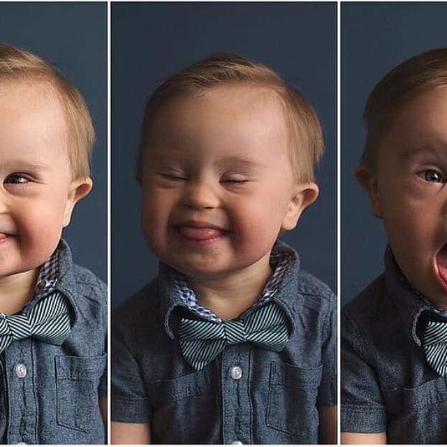 Особливості задньої поверхні рогівки у дітей із синдромом Дауна