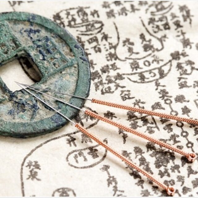 Клінічний кейс: акупунктура, синдром сухого ока та випадкове проколювання очей