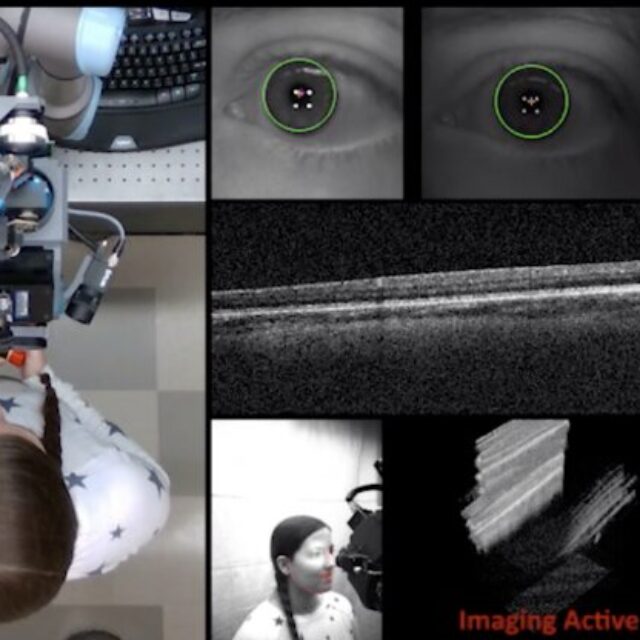 Автоматична роботизована рука, яка може значно полегшити захоплення діагностичних зображень ока