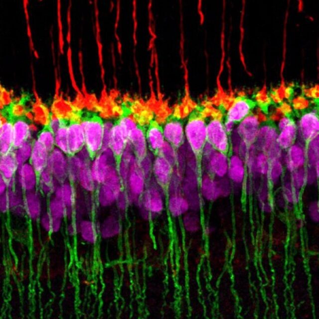 Вчені знайшли новий тип нейронів у сітківці ссавців