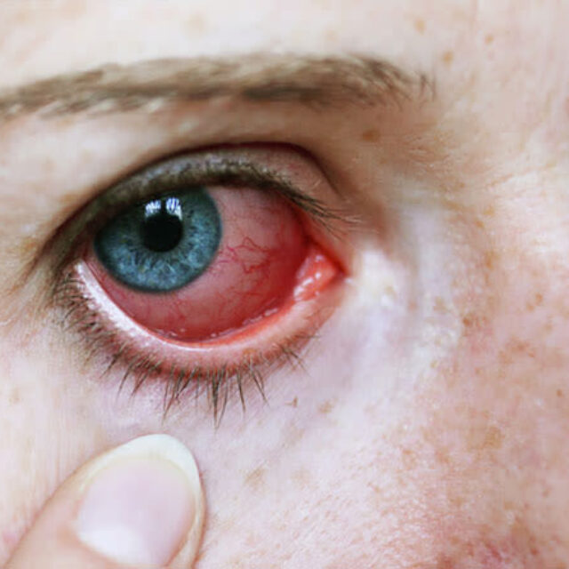 Імунні клітини відіграють значно більшу роль у захисті наших очей, аніж ми думали раніше