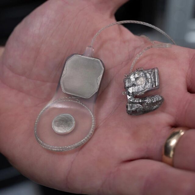 Скоро розпочнуться дослідження біончіного ока із участю людей