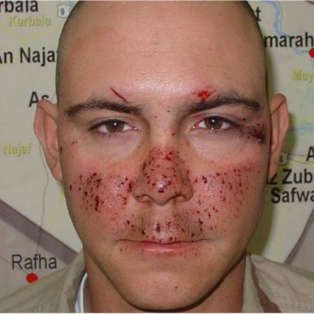 Чому використання захисних засобів очей в умовах війни є надважливим?