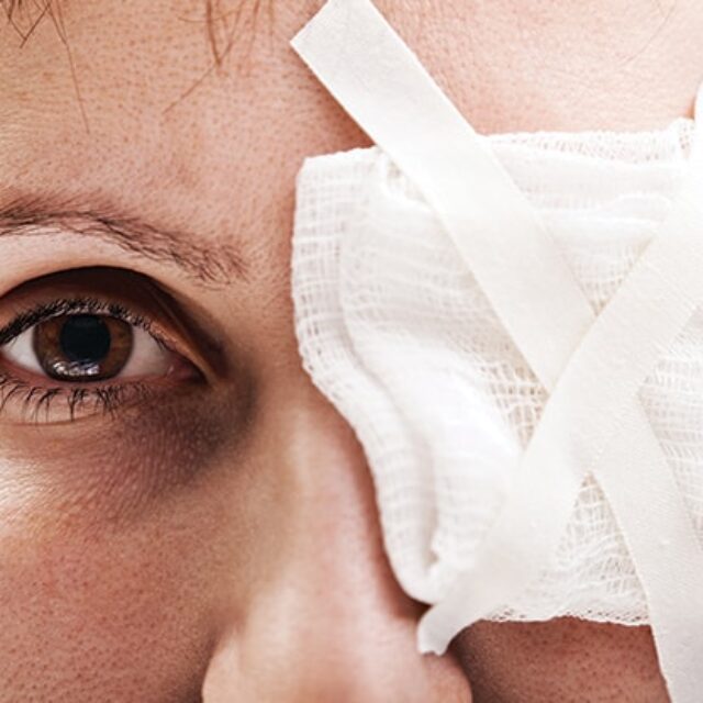 Особливості травм очей внаслідок терористичних актів