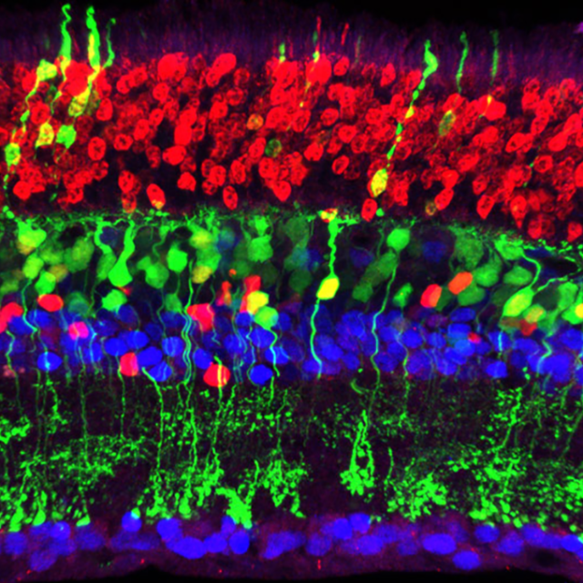 Вчені відтворили гангліонарні клітини сітківки мишей для того, щоб подолати нейродегенеративні захворювання очей