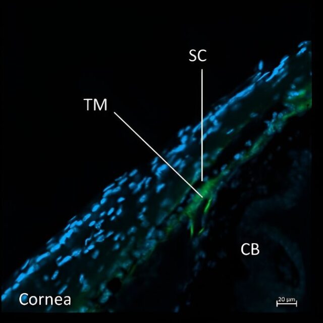 Віднайдено один із ключових механізмів регуляції внутрішньоочного тиску, що дає новий спектр потенційних терапевтичних можливостей