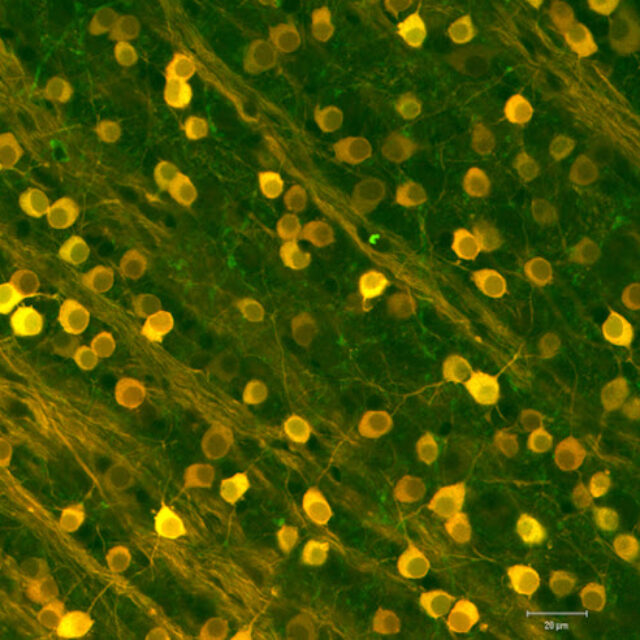 Нововиявлені особливості роботи гангліонарних клітин сітківки можуть стати багатообіцяючими для розробників зорових імплантів