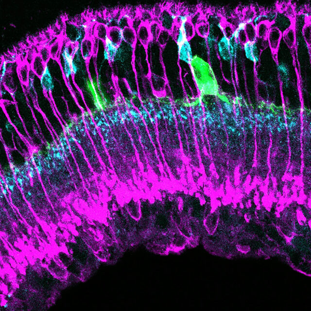 Нова молекула Ziapin2 може допомогти у відновленні зору при пігментному ретиніті та віковій макулярній дегенерації